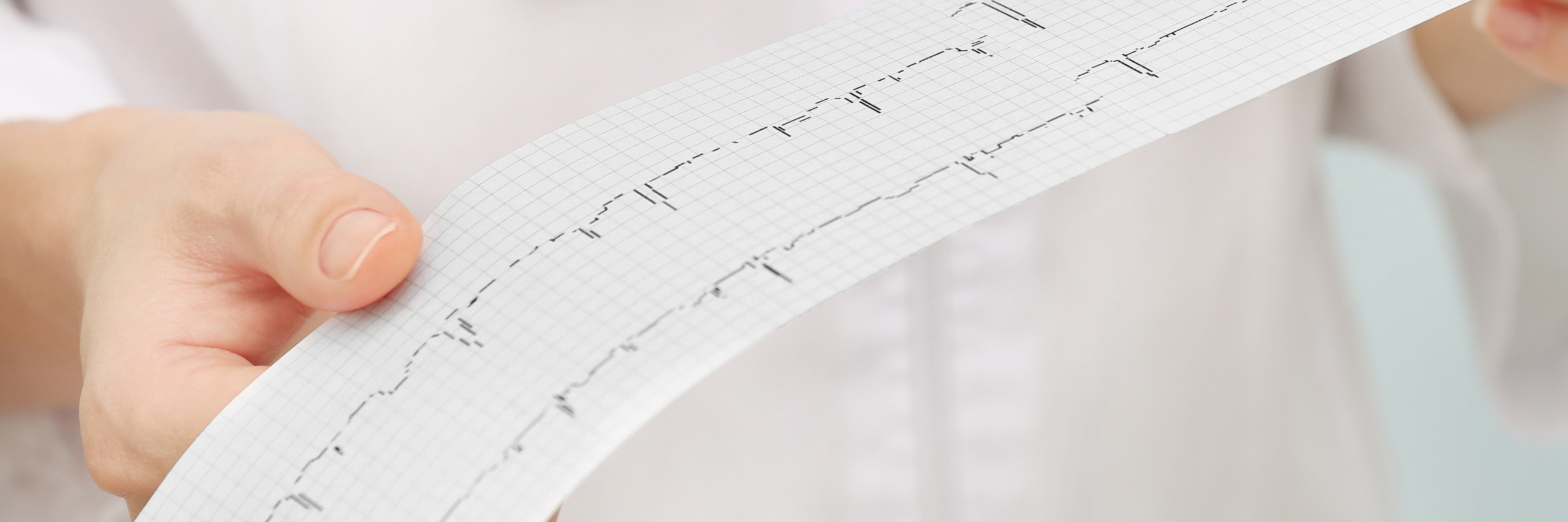 Electrocardiograma 4